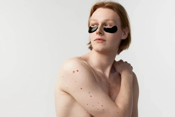 Taking care after skin with cosmetics. Young redhead man with eye patches posing shirtless against grey studio background. Concept of mens health, body and skin care, hygiene and male cosmetology