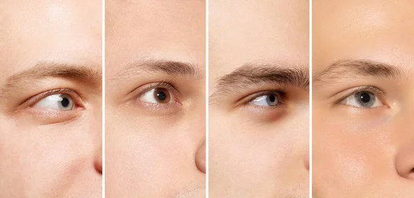 Collage Uppsättning Närbilder Manligt Ansikte Ögon Tittar Bort Sjukvård Syn — Stockfoto