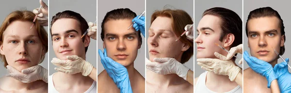コラージュ 美容師を訪れるさまざまな若い男性が美容注射で顔の治療をしています 蘇生だ 男性の健康 美しさ スキンケア 男性化粧品の概念 — ストック写真