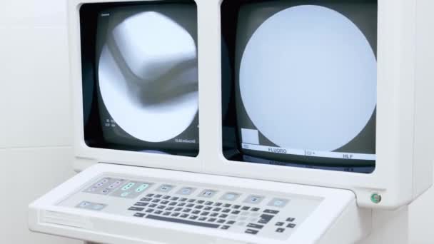 Effettuare Esami Utilizzando Fluorografia Moderna Controllare Ossa Gli Organi Interni — Video Stock