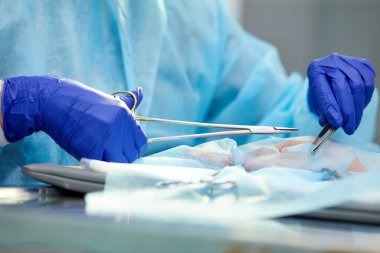 Doktorların yakın plan görüntüleri koruyucu eldivenler giymiş, cerrah insan eliyle ameliyat yapıyor, aletler kullanıyor. Tıp, hastane, sağlık, tedavi, meslek kavramı