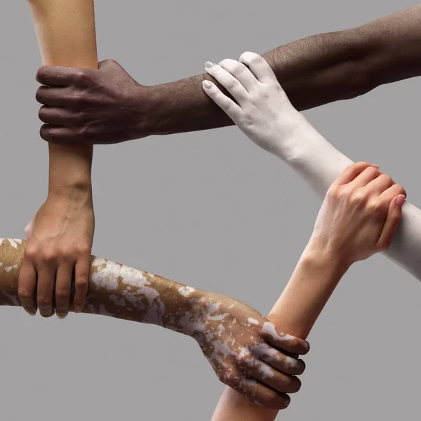 Человеческие Руки Различных Людей Разных Рас Тонус Кожи Поддерживающие Друг — стоковое фото