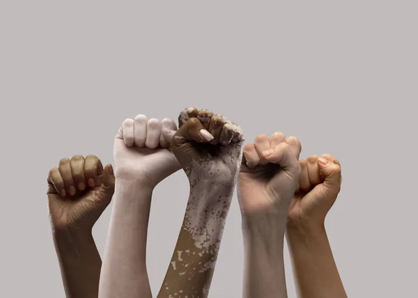 Hands Different People Diverse Race Skin Color Gender Raising Fists — Stock Photo, Image