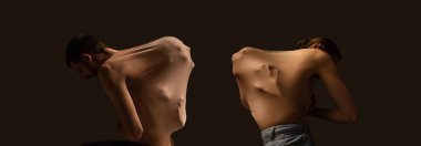 Duygular açığa çıkıyor. Kadın ve erkeklerin sırtından insan yüzü siluetleri çıkıyor. Sinir krizi geçiriyorum. Kavramsal kolaj. Psikoloji kavramı, iç dünya, duygular, gizli duygular, reklam