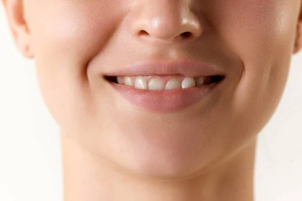 Обрезанное Изображение Женского Лица Белом Фоне Отбеливание Зубов Гигиена Полости — стоковое фото
