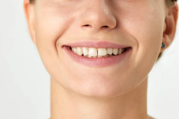 Immagine Ritagliata Volto Femminile Sorriso Denti Isolati Sfondo Bianco Denti — Foto Stock