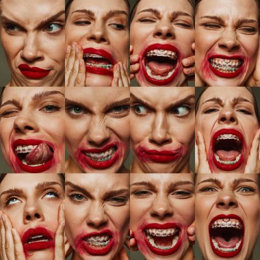 Diş telleri olan genç bir kadının dinamik kolajı. Öfkeden neşeye güçlü duygular gösteriyor. Kırmızı ruj yüz ifadelerini vurgular. Duygusal stres, akıl sağlığı, psikoloji konsepti