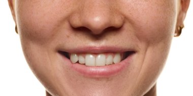 Yakın planda, gülümseyen, dişlerini gösteren, ağzını ve doğal cildini ön plana çıkaran, beyaz arka planda izole edilmiş çilleri olan genç bir kadın görüntüsü. Güzellik, diş bakımı, diş beyazlatma konsepti