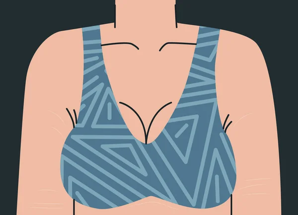 Gran Busto Femenino Sujetador Cuerpo Mujer Con Estrías Brazos Pecho — Vector de stock