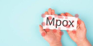 Mpox, maymun çiçeği isiliği olan eller, MPXV virüsü salgını, bulaşıcı hastalıkların yayılması