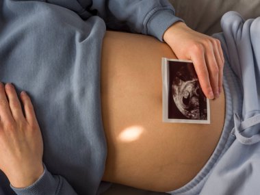 Müstakbel anne huzur içinde yatarken ultrason görüntüsü karnına nazikçe yerleştirildi. Ultrason görüntüsü hassas bağı yakalar, ultrason görüntüsü sakin doğum öncesi bağlantıyı güçlendirir. 