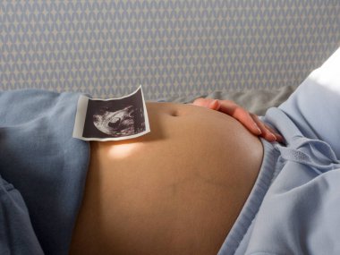 Müstakbel anne yatakta dinleniyor, karnına ultrason yerleştiriyor. Müstakbel anne mutluluğu kucaklarken, müstakbel anne ileride sevgi dolu bir ebeveyn olma beklentisiyle parıldıyor.. 