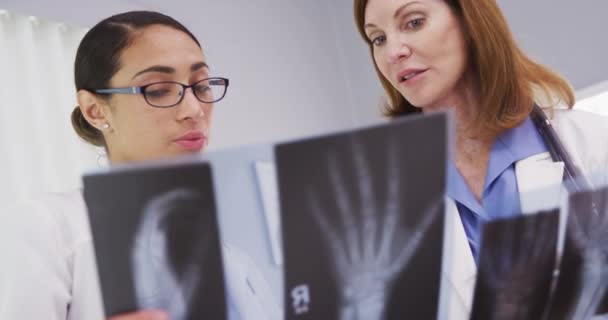 两名医生同事在办公室里仔细检查了多幅双手和手腕的X光照片 两名医生检查病人腕部X光的肖像 — 图库视频影像