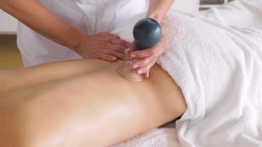 Unknown female therapist hands giving cupping treatment on a female back. Crop beautician massaging back of topless woman with suction cup during anti cellulite therapy. Close up, 4k video.