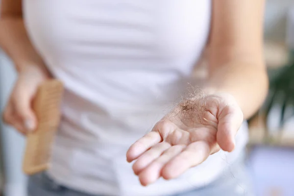 Рука Жінки Тримає Волосся Падає Гребеня Або Щітки Волосся Інтенсивна — стокове фото
