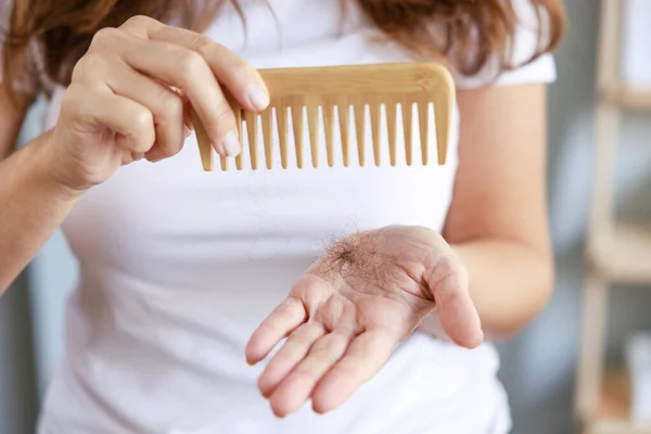 Woman Hand Holding Hair Fall Comb Hairbrush Intense Hair Loss — Stock Photo, Image
