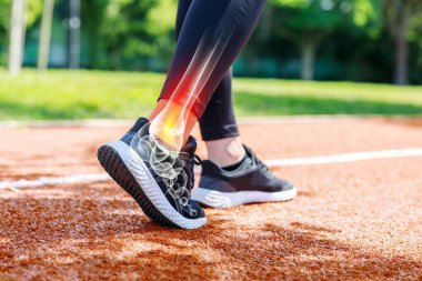 Atletizm sahasında yürüyen bayan sporcu, düşük açılı ayakkabı ve ayak bileği röntgen görüntüsüyle sportif yaralanma gösteriyor. Spor sakatlıkları konsepti