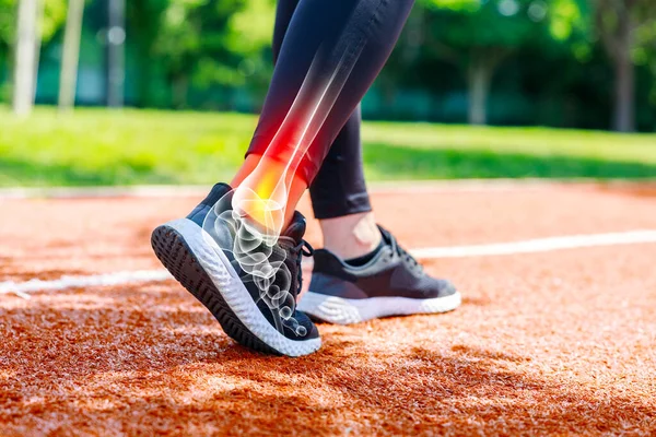 Female athlete walking on track field, low angle view of her shoes and ankle with x-ray image showing sportive injury. Sports injuries concept