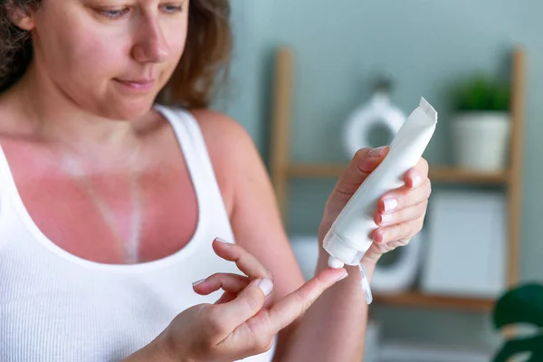 Junge Frau Trägt Feuchtigkeitscreme Auf Sonnenverbrannte Haut Auf Sonnengebrannte Haut — Stockfoto