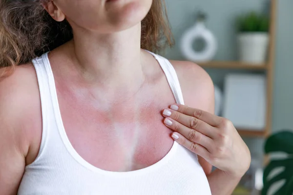 Kvinna Med Solbränna Huden Med Spår Baddräkt Solbränd Hud Bröstet — Stockfoto