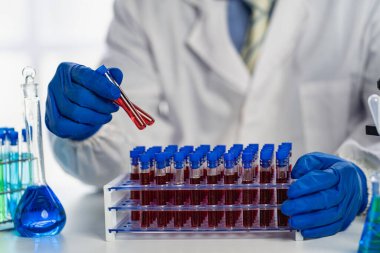 Tıbbi araştırma ve geliştirme konseptleri için klinik laboratuarında damar sağlığı doktoru. Bir mikroskop ve yanına yerleştirilmiş bir test tüpü ile bilim.