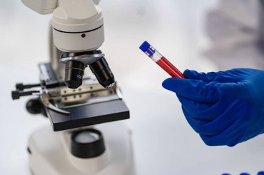 Tıbbi araştırma ve geliştirme konseptleri için klinik laboratuarında damar sağlığı doktoru. Bir mikroskop ve yanına yerleştirilmiş bir test tüpü ile bilim.