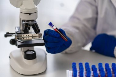 Tıbbi araştırma ve geliştirme konseptleri için klinik laboratuarında damar sağlığı doktoru. Bir mikroskop ve yanına yerleştirilmiş bir test tüpü ile bilim.