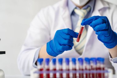 Doktor bir kan damarını tutuyor ve onu bir hastane laboratuvarında analiz ediyor.