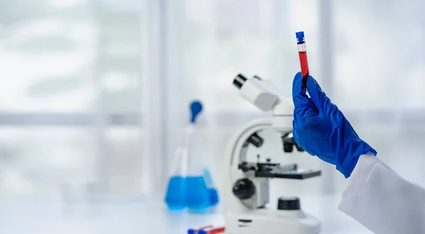 Professional doctor examining arterial blood sample, professional research in nurse with microscope Close up of blood test tube held by female lab assistant in lab office