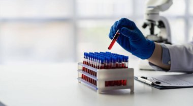 Doctor's hands in medical gloves holding a test tube with red blood for the sagittal microscopic test in the hematology laboratory at the hospital
