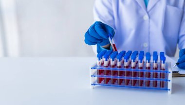 Tıbbi araştırmacı ve mavi lateks eldivenler mikropları önlemek için bir hastanın kan damarlarının laboratuardaki araştırma deneylerine götürüldüğünü gösteriyor..