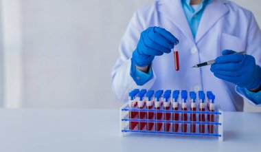 Tıbbi araştırmacı ve mavi lateks eldivenler mikropları önlemek için bir hastanın kan damarlarının laboratuardaki araştırma deneylerine götürüldüğünü gösteriyor..