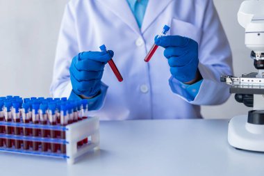 Tıbbi araştırmacı ve mavi lateks eldivenler mikropları önlemek için bir hastanın kan damarlarının laboratuardaki araştırma deneylerine götürüldüğünü gösteriyor..