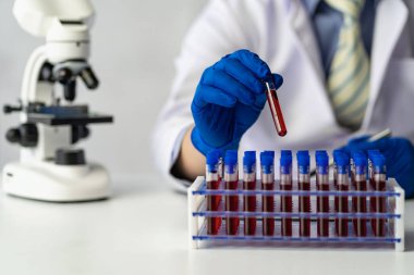 Analiz için kan damarlarını tutan ve laboratuvardaki kan örneklerini laboratuvarda analiz cihazıyla inceleyen doktor.