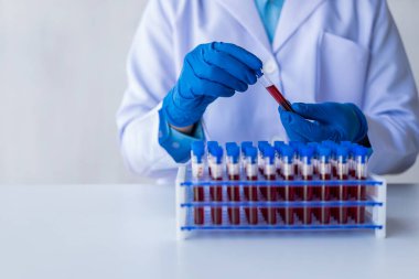 Analiz için kan damarlarını tutan ve laboratuvardaki kan örneklerini laboratuvarda analiz cihazıyla inceleyen doktor.