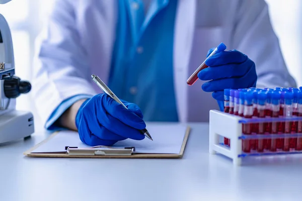 stock image Doctor holding blood vessels for analysis and checking blood in research laboratory blood sample from rack with analyzer in lab