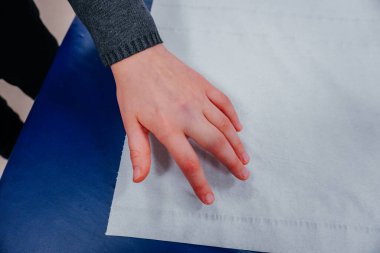 Childs 'ın Şişmiş Parmağı: Olası bir çatlağın yakın çekimi, parmakları şişmiş bir çocuk eli, muhtemelen kırık ya da burkulmayı gösteriyor. Pediatrik sağlık hizmetleri, yaygın çocukluk yaraları.