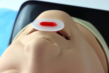 Eklenmiş Orofarengeal solunum yolu olan yetişkin bir hastaya yakından bakın.