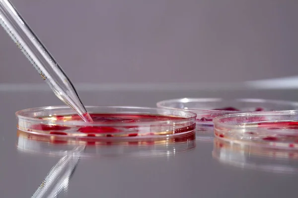 stock image Close up petri dishes with blood and pipette. DNA analysis concept.