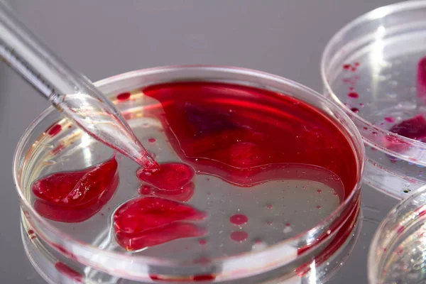 stock image Close up lab agar with blood samples. Petri dish on gray background.