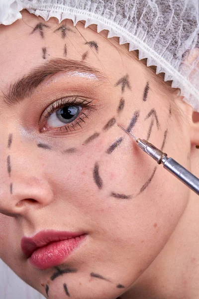 Nahaufnahme Kosmetische Botox Injektion Junge Frau Gesicht Graue Kosmetikspritze — Stockfoto