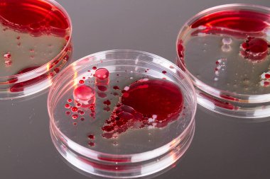 Close up of glass agars with blood samples. Petri dishes for scientific reserach. clipart