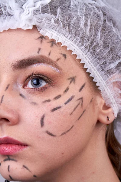 Vertical Shot Womans Face Dotted Lines Face Lift Surgery — Stock Photo, Image