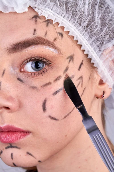 Nahaufnahme Des Skalpells Der Nähe Junger Frauen Gesicht Beauty Operation — Stockfoto