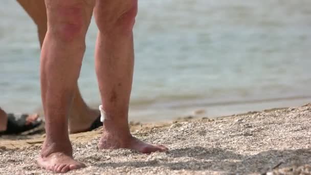 Ноги Отставной Старушки Мужчины Варикозом Бабушка Избыточным Весом — стоковое видео