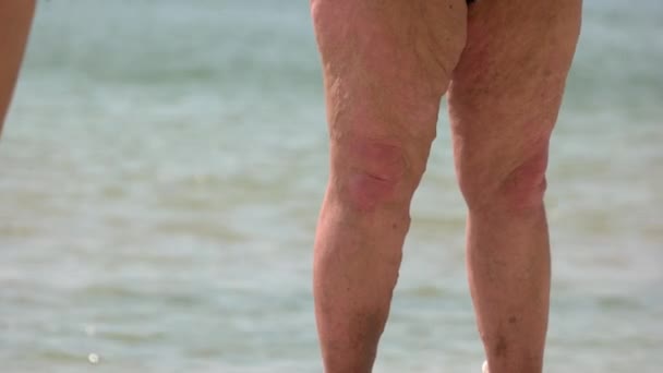 Emekli Yaşlı Kadının Varisli Adamın Bacaklarını Kapat Kilolu Büyükanne — Stok video