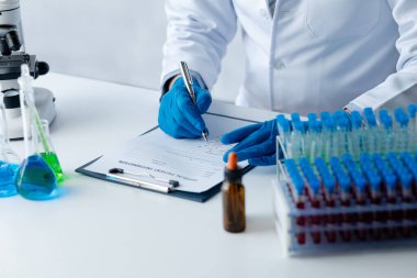 Lab assistant, a medical scientist, a chemistry researcher holds a glass tube through the blood sample, does a chemical experiment and examines a patient's blood sample. Medicine and research concept.
