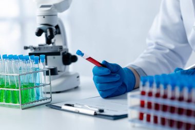 Laboratuvar asistanı, tıp bilimcisi, kimya araştırmacısı kan örneğinde cam bir tüp tutuyor, kimyasal bir deney yapıyor ve hastanın kan örneğini inceliyor. Tıp ve araştırma konsepti.