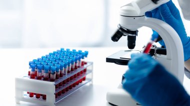 Laboratuvar asistanı, tıp bilimcisi, kimya araştırmacısı kan örneğinde cam bir tüp tutuyor, kimyasal bir deney yapıyor ve hastanın kan örneğini inceliyor. Tıp ve araştırma konsepti.