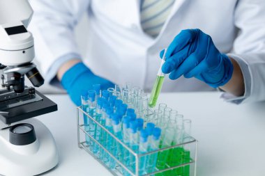 Lab assistant, a medical scientist, a chemistry researcher holds a glass tube through the blood sample, does a chemical experiment and examines a patient's blood sample. Medicine and research concept.